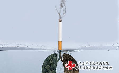 长春牛皮癣医院-5.31世界无烟日呼吁牛皮癣患者戒烟正当时！